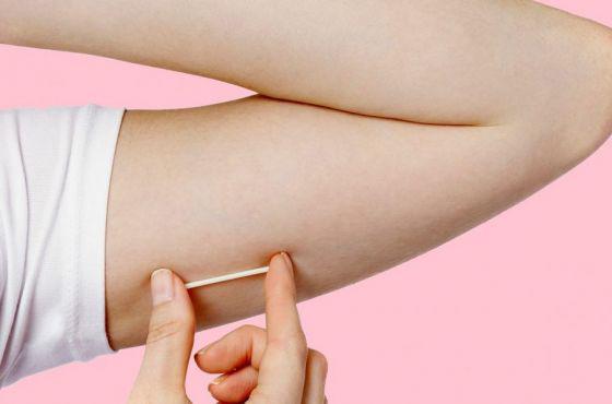 89142-colocaran-implantes-subdermicos-anticonceptivos-a-mujeres-de-hasta-19-anios (1)