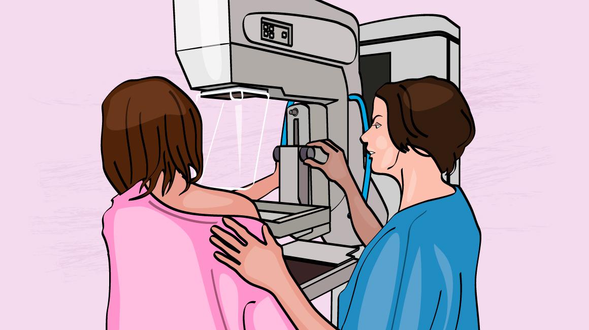 mamografia-2