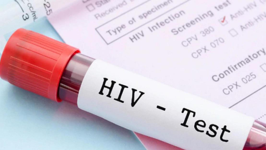 hiv