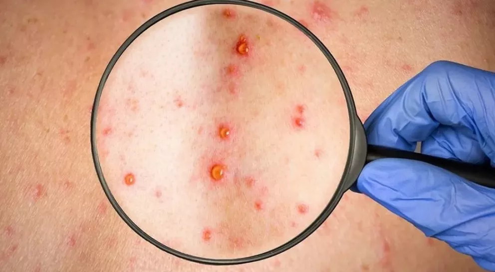 multimedia.normal.9a627a5706a5390d.76697275656c615f6e6f726d616c2e77656270