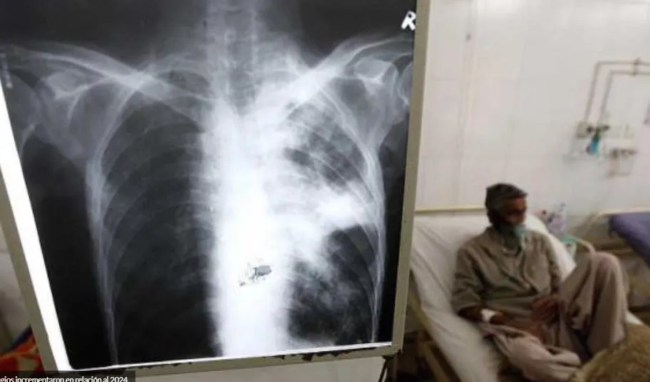 NOTICIA 6 TUBERCULOSIS SALTA