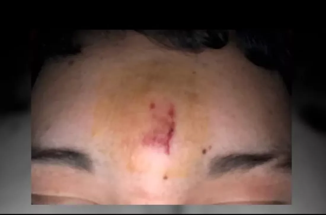 116968-rosario-un-docente-le-arrojo-un-borrador-a-un-alumno-para-callarlo