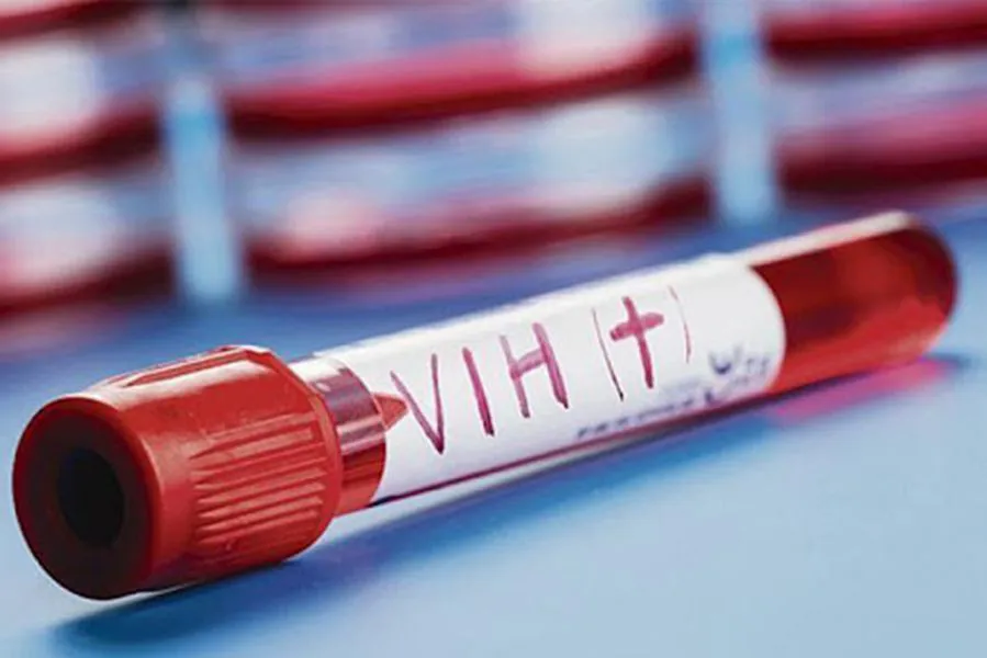 79367-el-vih-no-ha-desaparecido-y-continua-transmitiendose-en-todo-el-mundo
