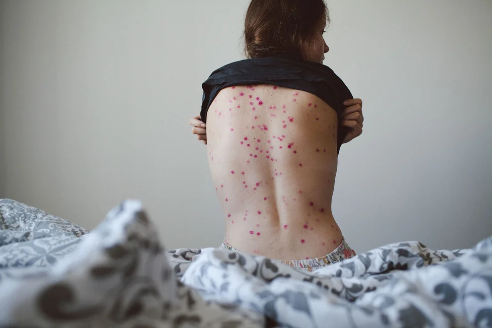 5C2WKO7ZUNCCPHPNAB6VEQD3QQ